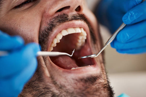 Best Emergency Gum Treatment in Eagle Mountain, UT